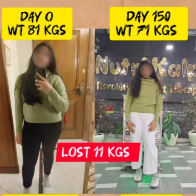 From 81 kgs to 71 kgs in 150 days. This 11 kg weight loss journey shows the power of consistency and a balanced diet plan that fits into your daily life.