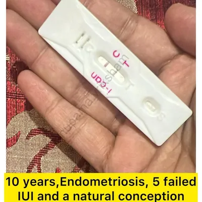 10 years of trying, endometriosis, and 5 failed IUIs. This picture of a natural conception is a powerful story of hope. Sometimes, preparing the body is all it takes.