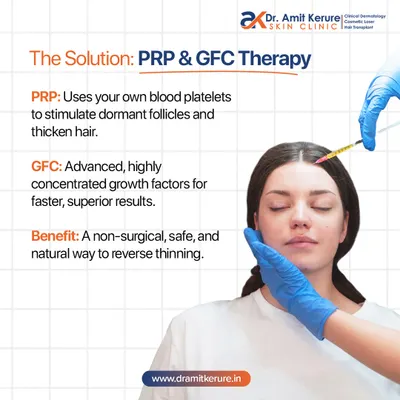 This graphic explains my primary non-surgical solutions. PRP uses your own blood platelets to stimulate follicles, while GFC is a more advanced, concentrated version for superior results. Both are safe, natural ways to reverse hair thinning.