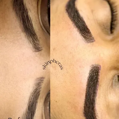 A striking before and after of our eyebrow permanent makeup service. We create perfectly shaped, full brows that frame the face and eliminate the need for daily makeup application.