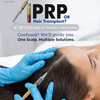 Are you confused between PRP and a hair transplant? This graphic helps clarify the choice. PRP is generally for early-stage thinning, while a transplant is for established bald patches. At my clinic, we will guide you to the right solution for your scalp.