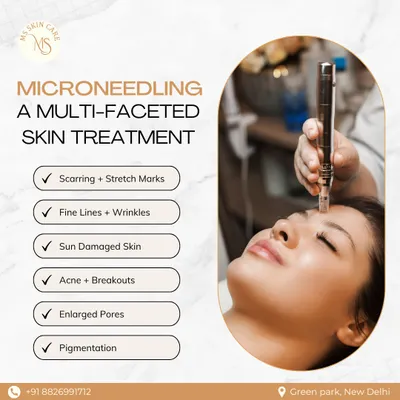 Microneedling is a versatile treatment that addresses multiple skin concerns at once. As this graphic shows, it is effective for scarring, stretch marks, fine lines, sun damage, enlarged pores, and pigmentation by promoting skin regeneration.