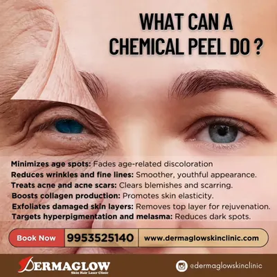A chemical peel is a versatile treatment that addresses multiple skin concerns at once. This visual explains how the procedure works to minimize age spots, reduce fine lines, treat acne and scarring, and boost collagen. It is a powerful tool for comprehensive skin rejuvenation.
