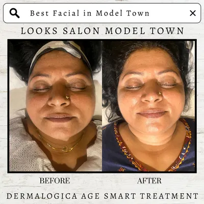 Another look at the incredible brightening and smoothing effects of our Dermalogica Age Smart Treatment. We focus on targeting signs of aging to restore vitality and a youthful glow.