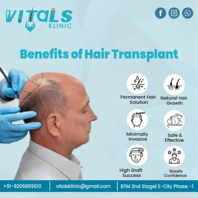 This graphic summarizes the key benefits of a hair transplant. It is a permanent solution that provides natural hair growth through a minimally invasive and safe procedure. The high success rate of graft survival directly translates to a significant boost in confidence for our patients.