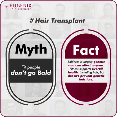 A series of graphics debunking common myths about fitness and hair loss, such as whether exercise, sweating, or high-protein diets cause baldness.