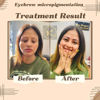 A happy client showcases her new look after an eyebrow microblading session. We transformed her brows to be fuller and more defined, framing her face beautifully.