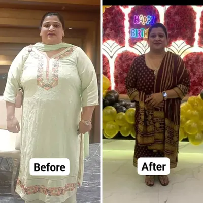 Charanjeet Kaur's before and after photos show more than just a 20 kg weight loss. They represent a journey of overcoming acute osteoarthritis pain and heart-related problems to become fitter than ever.