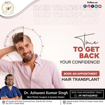 This visual shows the transformative potential of a hair transplant. My focus is on designing a hairline that suits your facial structure, creating a result that helps you regain your confidence.