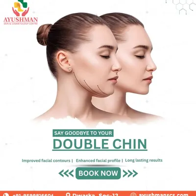 A defined jawline can dramatically enhance your facial profile. We offer specialized, non-surgical double chin reduction treatments designed to target submental fat, resulting in improved facial contours and a sharper, more confident look with long lasting results.