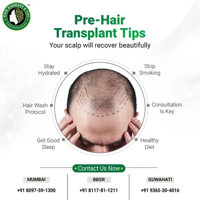 Preparing for your hair transplant is crucial for a successful outcome. This graphic outlines key pre-transplant tips, including staying hydrated, stopping smoking, and following a healthy diet, to ensure your scalp recovers beautifully.