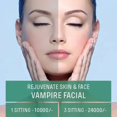 A before and after comparison of our Vampire Facial. This treatment rejuvenates the skin by using your own plasma to promote healing and collagen production, resulting in a brighter, smoother complexion.