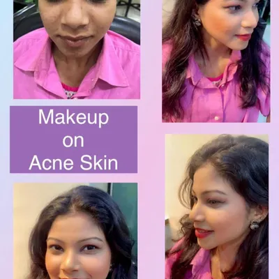 Creating a flawless finish on acne-prone skin is one of our specialties. Here, you can see how we achieved a smooth, even base that looks natural and feels lightweight. We use specific techniques to provide coverage without irritating the skin, helping you feel confident for your event.