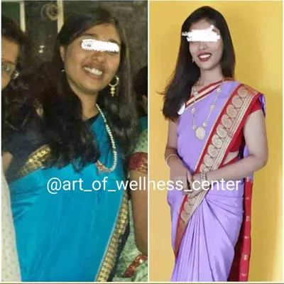 A side by side comparison showing a client's significant weight loss journey. Her posture, confidence, and overall appearance improved dramatically with a balanced diet and lifestyle changes.