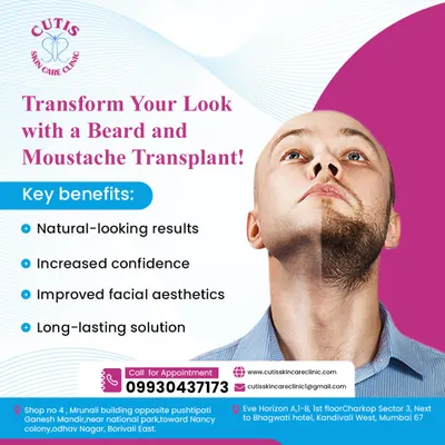 A powerful before and after visual of our beard and moustache transplant service. The image clearly contrasts a patchy beard with a full, sculpted one, demonstrating how we can improve facial aesthetics and provide a long-lasting solution for uneven facial hair.