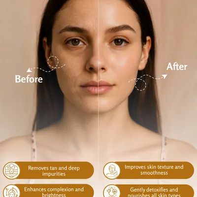 This before-and-after shows the effectiveness of my Ayurvedic Face Pack for tan removal and improving skin texture. The pack uses ingredients like Multani Mitti to draw out impurities and Aloe Vera to soothe and hydrate. It gently detoxifies the skin, enhancing complexion and restoring a smooth, bright appearance.