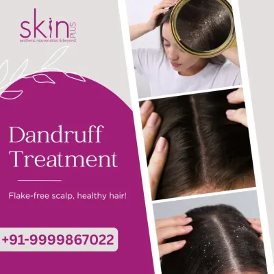 This graphic shows the visible signs of dandruff and the clear, healthy scalp that is achievable with professional treatment. My goal is to provide you with a flake-free scalp and healthier hair.