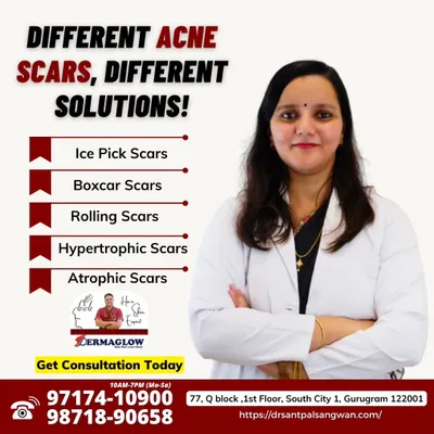 I understand that not all acne scars are the same. This graphic outlines the different types of scars we treat, including ice pick, boxcar, rolling, hypertrophic, and atrophic scars. My approach is to first identify your specific scar type to create a targeted and effective treatment plan.