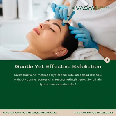 A patient receiving a HydraFacial treatment. This procedure uses a specialized device for gentle yet effective exfoliation, removing dead skin cells without the redness or irritation of traditional methods, making it suitable for all skin types.