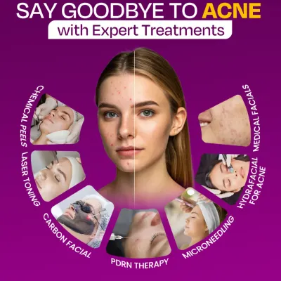 Acne can be frustrating, but we have a range of expert treatments to help. From medical facials and chemical peels to advanced laser therapies, we find the right solution for your specific skin concerns.