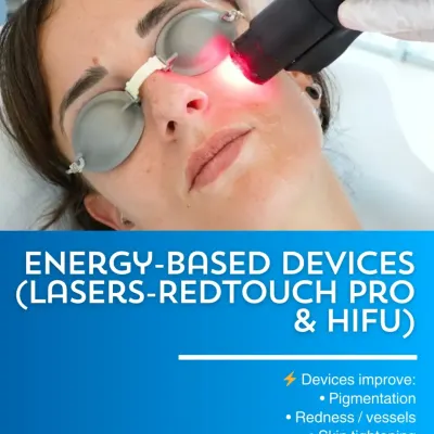 For under-eye pigmentation and mild laxity, we use advanced energy-based devices like the RedTouch PRO laser. This technology helps improve discoloration and provides a gentle tightening effect to rejuvenate the area.
