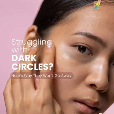 If you're struggling with dark circles that won't go away, it's important to understand the cause. This series of images explains why they appear and what can be done.