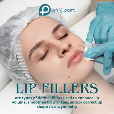 A client receiving a lip filler injection. This procedure uses dermal fillers to enhance lip volume, smooth wrinkles around the mouth, and correct any shape or size asymmetry.