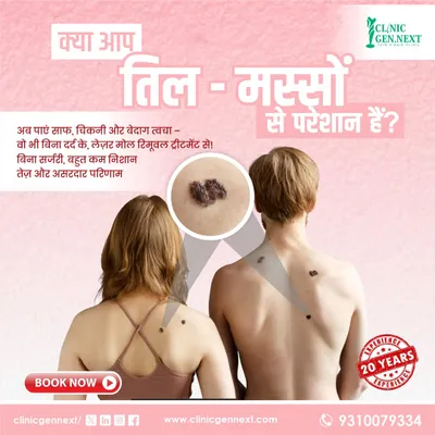 This graphic summarizes the key benefits of my laser treatment for moles and warts. It is a non-surgical procedure that is both painless and leaves behind minimal to no scars for clear skin.