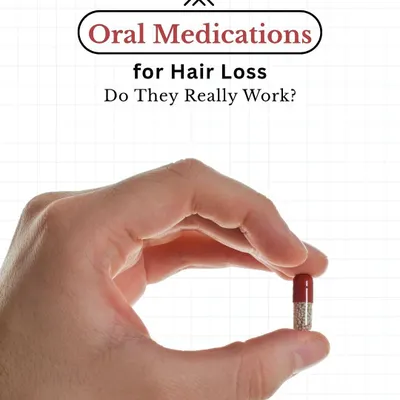 Do oral medications for hair loss really work? Yes, but only with the right diagnosis and expert care from a dermatologist.