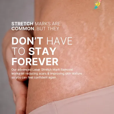 Stretch marks are common, but they don't have to be permanent. Our advanced laser treatments work on improving skin texture and reducing the appearance of scars, whether they are from weight changes, pregnancy, or other factors.