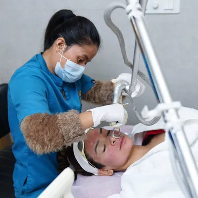A close up view of a fractional laser treatment in progress. This procedure creates micro-injuries in the skin to trigger natural collagen production, effectively resurfacing the skin to treat acne scars and improve texture.