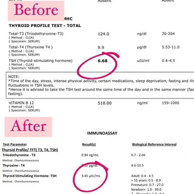 Thyroid Health Transformation: This before-and-after report shows a client's TSH level improving from 6.68 to 3.45 in two months. This is a clear, measurable result of our root cause approach to managing thyroid and hormonal health.