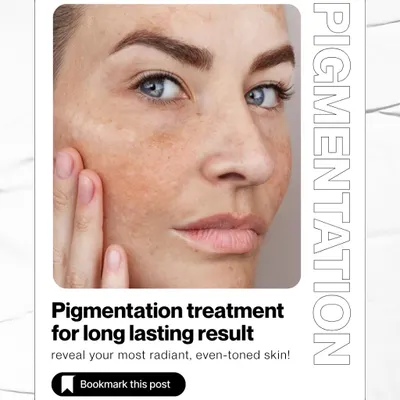 This is your guide to achieving long-lasting results for pigmentation. My approach is to reveal your most radiant, even-toned skin through a customized combination of treatments.