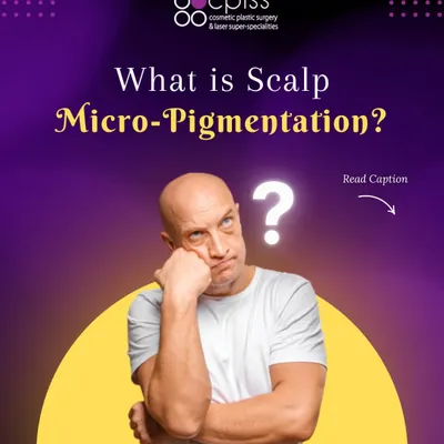Scalp Micropigmentation, or SMP, is a non-surgical technique I use to create the illusion of fuller hair. It's an excellent solution for adding density, camouflaging scars, or defining a hairline for those who may not be candidates for a transplant.