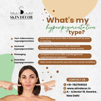 Hyperpigmentation is not a single condition. This graphic explains the different types I commonly see, from post-inflammatory marks left by acne to hormonal patches and sunspots. Knowing your type is the first step toward effective treatment.