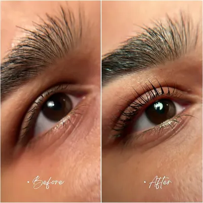 A perfect example of a lash lift and tint transformation. This service enhances your natural lashes by giving them a beautiful curl and a darker tint, making them appear longer and fuller. The result lasts for weeks.