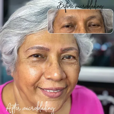 A beautiful transformation for this client. My goal with microblading is often to create brows that look so natural, you can't tell they've been tattooed. This procedure is suitable for any age, giving a youthful lift to the face. The results will fade to an even softer, more natural shade.