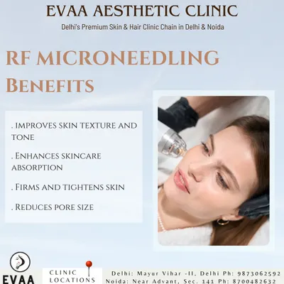 The benefits of RF Microneedling, a powerful treatment that combines radiofrequency and microneedling. It improves skin texture and tone, enhances skincare absorption, firms and tightens skin, and reduces pore size.