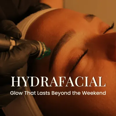 The Hydrafacial is a classic for a reason. It provides a deep cleanse and lasting hydration that goes beyond a regular facial, giving you a glow that lasts well beyond the weekend.