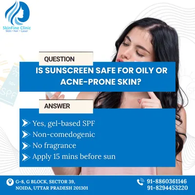 This graphic answers a common question: Is sunscreen safe for oily or acne prone skin? The answer is yes, provided you use a gel based, non comedogenic formula.