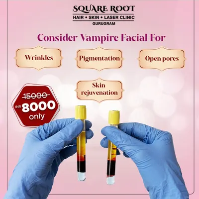 The Vampire Facial, or PRP, is a powerful skin rejuvenation treatment. This graphic shows the test tubes containing the client's own blood, which has been processed to concentrate the platelets and growth factors used in the facial.