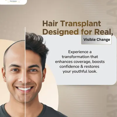 This is the transformation I aim for. It's not just about adding hair, but about restoring a youthful look and the confidence that comes with it. This split-view shows the visible change possible with our MicroFUE hair transplant.