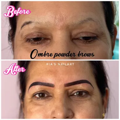 This is a fantastic brow transformation using the Ombre Powder Brows technique. This method creates a soft, shaded look, similar to using brow powder. The brows will heal to be 40% lighter, leaving a beautiful and natural-looking brow stain that can last up to 3 years.