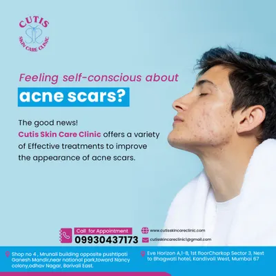 If you are feeling self-conscious about acne scars, know that there is good news. At my clinic, I offer a variety of effective treatments, from microneedling to laser therapy, to significantly improve the appearance of scars and restore your skin's smooth texture.