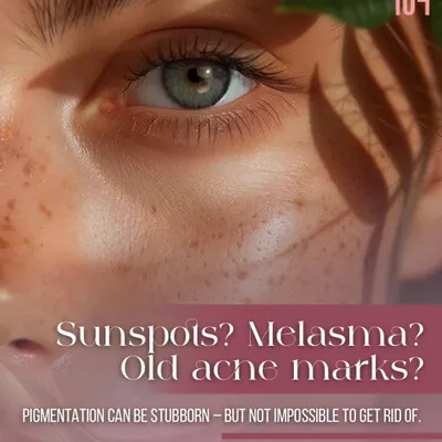 Are you dealing with sunspots, melasma, or old acne marks? Pigmentation can be stubborn, but it's not impossible to treat. We offer advanced solutions to get rid of uneven skin tone for good.