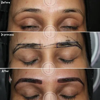 This three-step image clearly shows my meticulous process. We start with your natural brows, then I carefully map out the new shape for your approval, and only then do I perform the procedure. The result is a pair of perfectly shaped, semi-permanent brows.