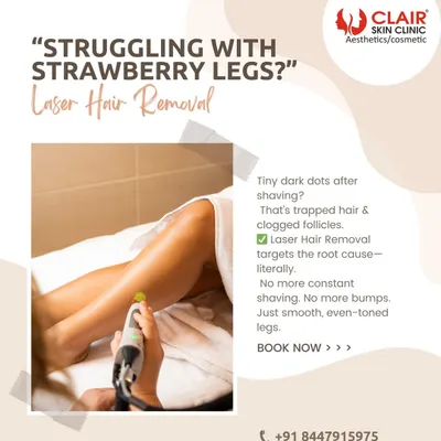 If you're struggling with "strawberry legs" or tiny dark dots after shaving, you are not alone. Our laser hair removal targets the root cause by treating trapped hair and clogged follicles for smooth, even-toned legs.