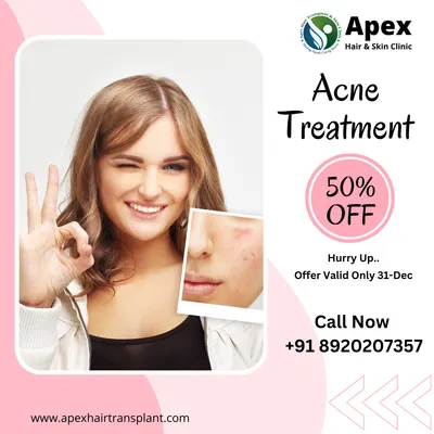 Don't let acne control your confidence. We offer dermatologist-led acne treatments that are non-invasive and designed to deliver clear results. This image highlights the transformative effect of our targeted solutions, helping you move towards blemish-free skin.