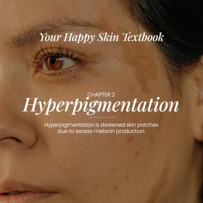 Welcome to your happy skin textbook. In this chapter, we delve into hyperpigmentation, which is the darkening of skin in patches due to excess melanin production.