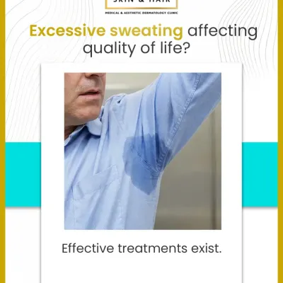 Excessive underarm sweating, as shown in this image, is a primary symptom of hyperhidrosis. It's a medical condition for which effective, evidence-based treatments exist to restore comfort and confidence.